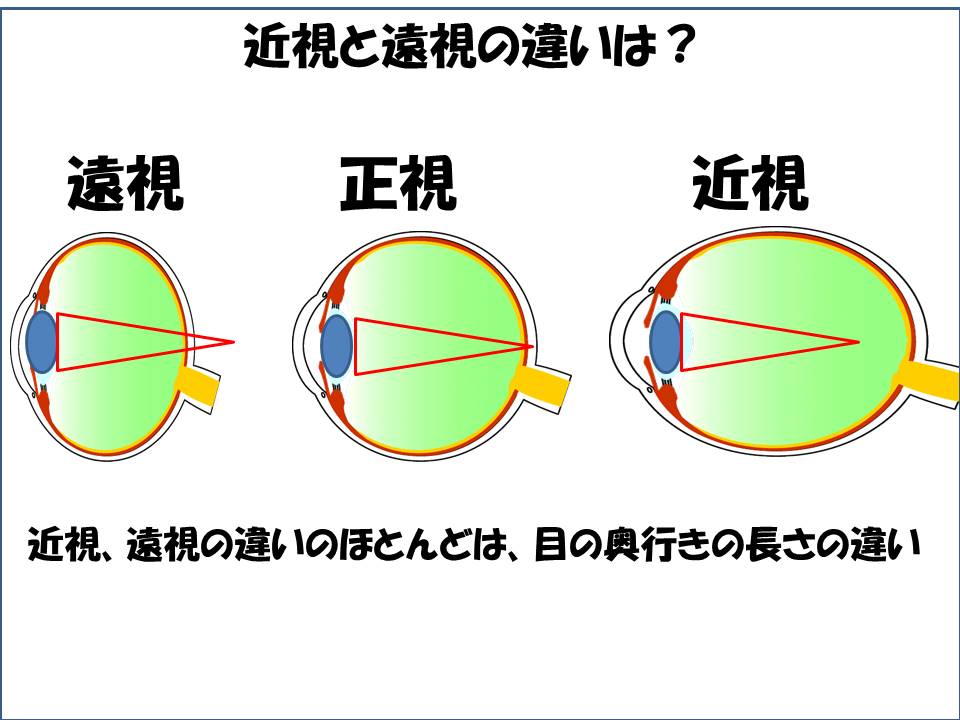 目がいい人と悪い人の 目の形 の違いとは まつもと眼科 公式サイト 下関市東駅で日帰り白内障手術