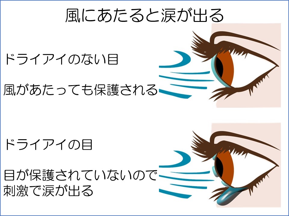 風に当たる
