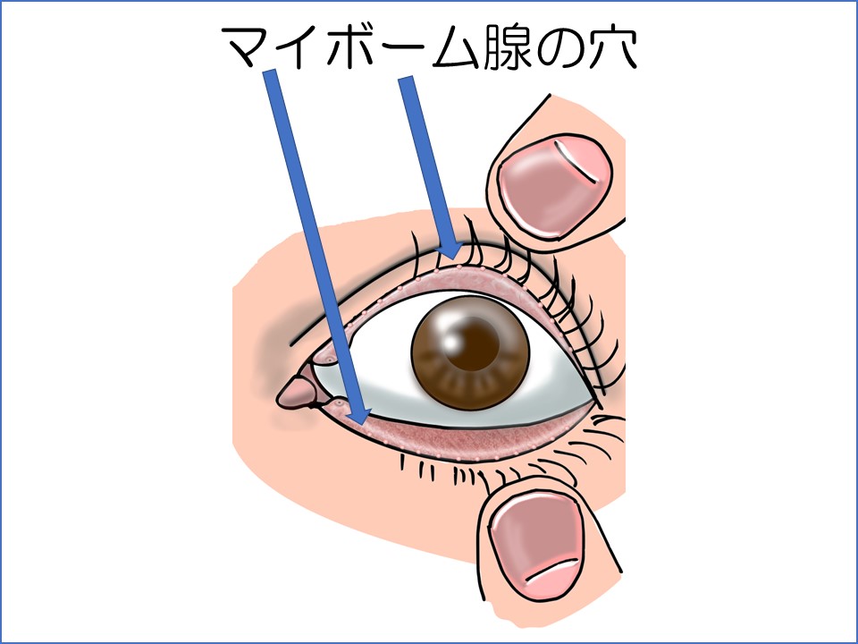 あんぽう