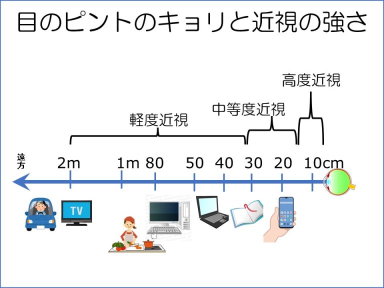 自分の近視の度数を調べるには？（視力と近視の度数の関係は？） まつもと眼科 公式サイト。下関市東駅で日帰り白内障手術