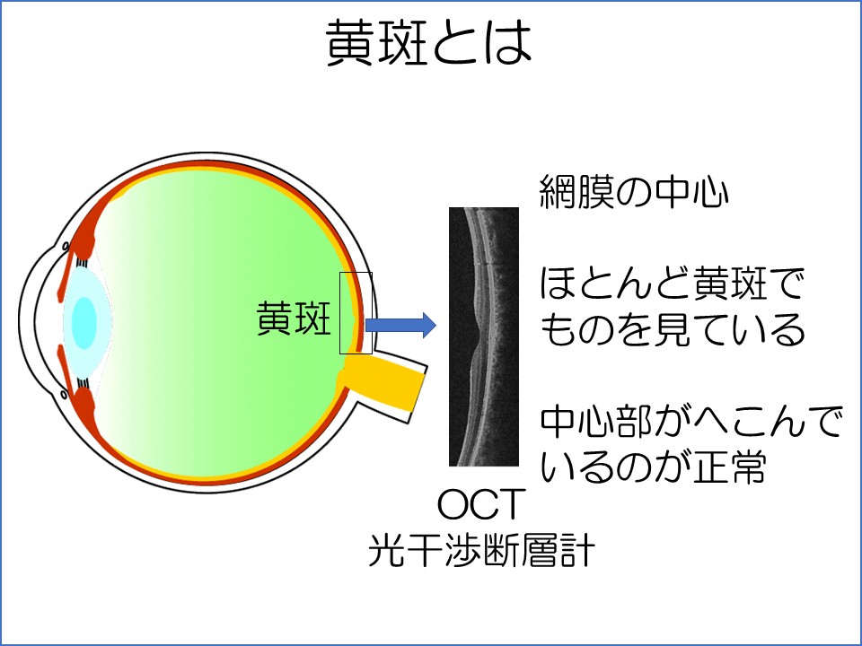 黄斑疾患の病態理解と治療【裁断済】 黄斑疾患診療AtoZ 第2版 | 書籍詳細 | 書籍 | 医学書院